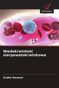 Produktbild: Niedokrwisto&iquest;&iquest; sierpowatokrwinkowa