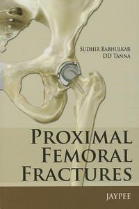 Produktbild: Proximal Femoral Fractures