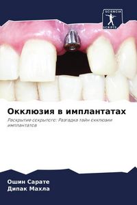 Produktbild: Okkl&uuml;ziq w implantatah