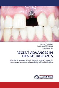 Produktbild: Recent Advances in Dental Implants
