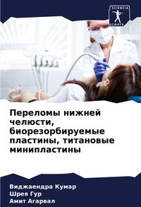 Produktbild: Perelomy nizhnej chel&uuml;sti, biorezorbiruemye plastiny, titanowye miniplastiny