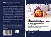 Produktbild: Jeffektiwnost' biomarkerow serdca pri ostrom koronarnom sindrome