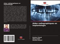 Produktbild: Aides radiographiques en implantologie