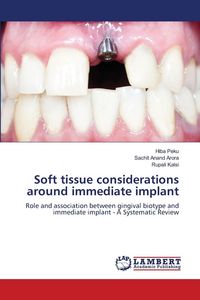 Produktbild: Soft tissue considerations around immediate implant