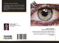 Produktbild: Occlusions veineuses r&eacute;tiniennes