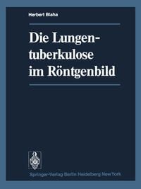 Produktbild: Die Lungentuberkulose im R&ouml;ntgenbild