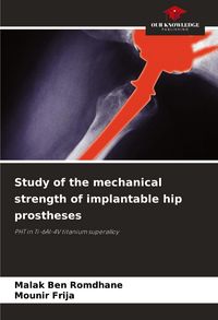 Produktbild: Study of the mechanical strength of implantable hip prostheses