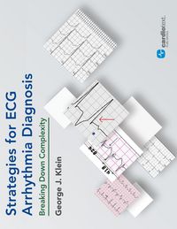 Produktbild: Strategies for ECG Arrhythmia Diagnosis