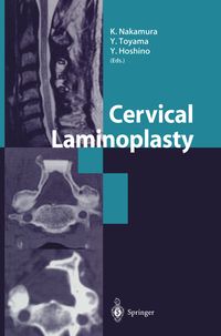 Produktbild: Cervical Laminoplasty