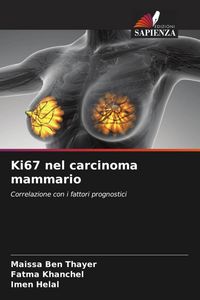 Produktbild: Ki67 nel carcinoma mammario