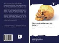 Produktbild: Fibro-oss&auml;re L&auml;sionen des Kiefers