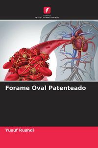 Produktbild: Forame Oval Patenteado