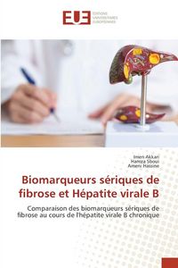 Produktbild: Biomarqueurs s&eacute;riques de fibrose et H&eacute;patite virale B