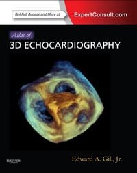 Produktbild: Atlas of 3D Echocardiography E-Book