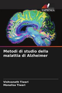 Produktbild: Metodi di studio della malattia di Alzheimer