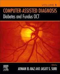 Produktbild: Diabetes and Fundus OCT