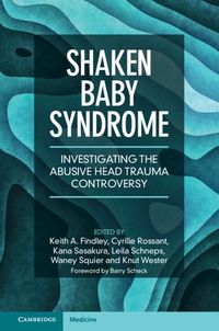 Produktbild: Shaken Baby Syndrome