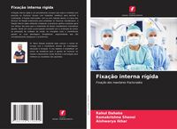 Produktbild: Fixa&ccedil;&atilde;o interna r&iacute;gida