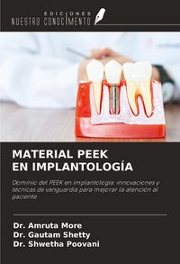 Produktbild: Material Peek En Implantolog&iacute;a