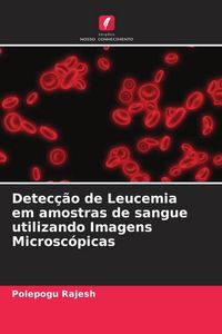 Produktbild: Detec&ccedil;&atilde;o de Leucemia em amostras de sangue utilizando Imagens Microsc&oacute;picas