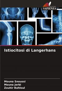 Produktbild: Istiocitosi di Langerhans