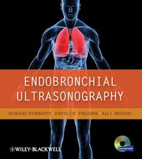 Produktbild: Endobronchial Ultrasonography