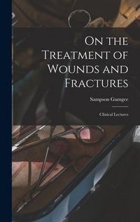 Produktbild: On the Treatment of Wounds and Fractures: Clinical Lectures