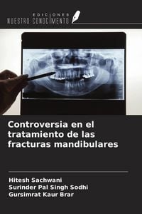 Produktbild: Controversia en el tratamiento de las fracturas mandibulares