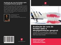 Produktbild: Avalia&ccedil;&atilde;o da cura de feridas ap&oacute;s a despigmenta&ccedil;&atilde;o gengival