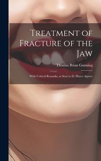 Produktbild: Treatment of Fracture of the Jaw; With Critical Remarks, as Sent to D. Hayes Agnew