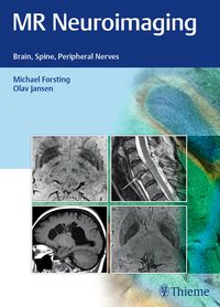 Produktbild: MR Neuroimaging