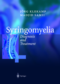 Produktbild: Syringomyelia