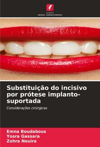 Produktbild: Substitui&ccedil;&atilde;o do incisivo por pr&oacute;tese implanto-suportada