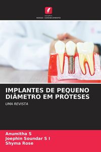 Produktbild: Implantes De Pequeno Di&acirc;metro Em Pr&oacute;teses