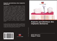 Produktbild: Aspects parodontaux des implants dentaires
