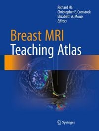 Produktbild: Breast MRI Teaching Atlas