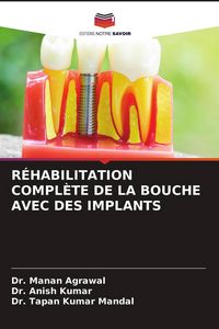 Produktbild: R&eacute;habilitation Compl&egrave;te De La Bouche Avec des Implants