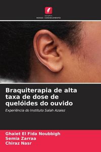 Produktbild: Braquiterapia de alta taxa de dose de quel&oacute;ides do ouvido
