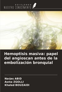 Produktbild: Hemoptisis masiva: papel del angioscan antes de la embolizaci&oacute;n bronquial