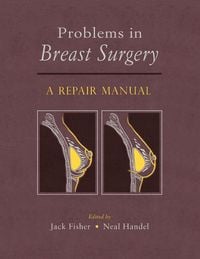 Produktbild: Problems in Breast Surgery