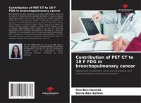 Produktbild: Contribution of PET CT to 18 F FDG in bronchopulmonary cancer