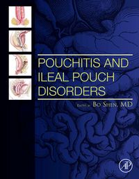 Produktbild: Pouchitis and Ileal Pouch Disorders