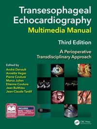 Produktbild: Transesophageal Echocardiography Multimedia Manual