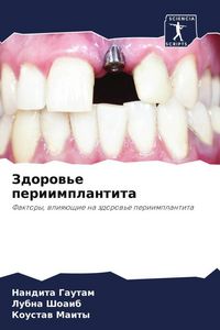Produktbild: Zdorow'e periimplantita