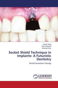 Produktbild: Socket Shield Technique in Implants: A Futuristic Dentistry
