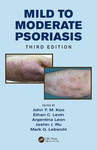 Produktbild: Mild to Moderate Psoriasis