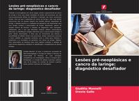 Produktbild: Les&otilde;es pr&eacute;-neopl&aacute;sicas e cancro da laringe: diagn&oacute;stico desafiador
