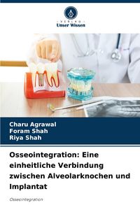 Produktbild: Osseointegration: Eine einheitliche Verbindung zwischen Alveolarknochen und Implantat