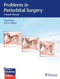 Produktbild: Problems in Periorbital Surgery
