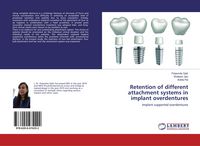 Produktbild: Retention of different attachment systems in implant overdentures